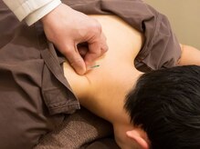 ハリコ 代官山/全身鍼灸とマッサージ