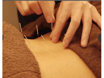 オアシス 上野(Oasis)の写真/初めての方でも◎お悩みに合わせた施術をご提案!!身体の不調はもちろん、美容鍼灸メニューで肌質改善♪