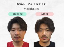 美容整体 ウェリナ 蟹江院/小顔矯正/骨盤矯正/痩身整体