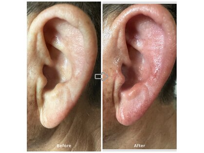 アサミミセラピー(asamimi therapy)の写真