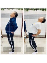 門前仲町イエティ鍼灸整骨院（旧：イエティ鍼灸整骨院）/ビィフォーアフター☆