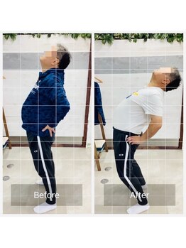 門前仲町イエティ鍼灸整骨院（旧：イエティ鍼灸整骨院）/ビィフォーアフター☆