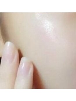 モテスリム/痛みの少ない低周波施術