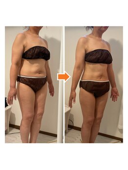 サルサナ(Salu Sana)/痩身！頑張らずに痩せた！感動！