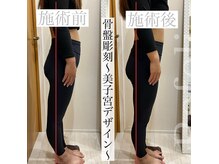 ラフェリ(Rafeli)の雰囲気（下半身太り/反り腰/生理不調/骨盤美子宮デザイン）