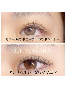 グリッターネイル(GLITTER NAILS)/アンドヘルシー　抜け感