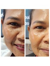 縁 整体院(en)/ララピール