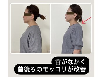 シャンタイン(SANTAI)/モンテセラピー★姿勢改善