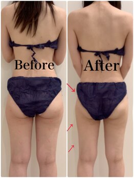 スペチアーレ 夙川/顔もボディもお悩み解決