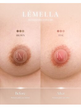 ハニー(Honey)/バストアップサロンHONEY恵比寿