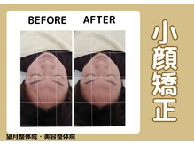 望月整体院/小顔矯正/矯正/小顔