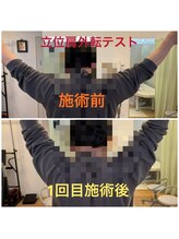 リファイン(Refine)/腕を横から上げる動きも楽に