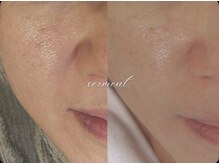 ボーテラボ 大宮(beaute LABO)