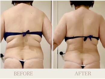 ピュウリリアーナ(Piu liliana)の写真/「ただ痩せるだけじゃない。全身を見ながら、美しいラインへ導くPIU LILIANAの本格痩身」