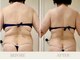 ピュウリリアーナ(Piu liliana)の写真/「ただ痩せるだけじゃない。全身を見ながら、美しいラインへ導くPIU LILIANAの本格痩身」