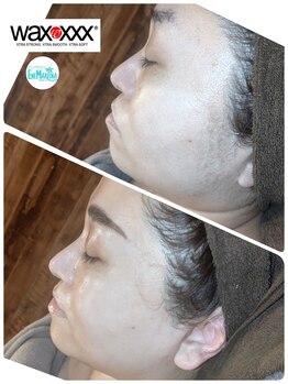 エネマリーナ 別邸(Enemariina)/