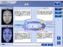 クリニカルエステ花蔵 熊谷八木橋店/Step3.肌診断
