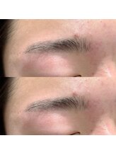 アンネ 伊丹店(ANNE)/メンズ美眉アイブロウWax脱毛