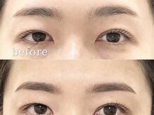 テヤン 大阪谷六店(teyan)/眉毛before/after