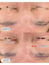 ベルファーム(Belle Femme)/目元に注目♪