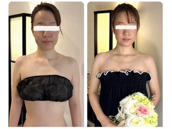 蒼(so)の写真/『写真映え抜群！』＜全方位視線集中の花嫁様こそ小顔矯正を＞絶賛！頭蓋骨から根本改善の痛ゼロ持続小顔。