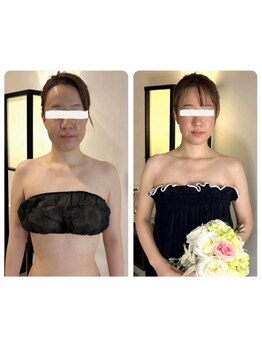 小顔になりたい