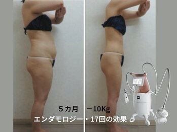 美と健康と痩身サロン マリアローズ(Maria Rose)/エンダモロジー痩身