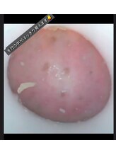 ベニバナ 五反田駅前/【カメラ付き☆イチゴ鼻撃退！】