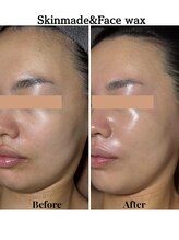 ラ ジェム(La gemme)/【フェイシャルワックス】