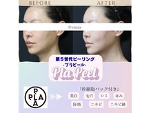 エミア(Emia)の雰囲気(【韓国発☆プラピール導入店】美白/赤み/毛穴/リフトアップにも!)