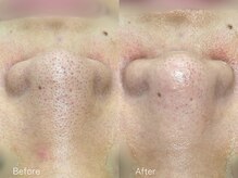 ミュー 栄本店(mieux)/お客様Before/After