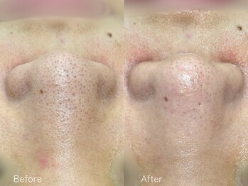 ミュー 栄本店(mieux)/お客様Before/After