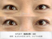 アストリエ グレース 相模大野(Astorie Grace)/目元エステ1回でも効果◎