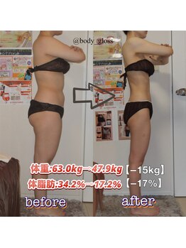 ボディグロス 梅田店(BODY GLOSS)の写真/LDダイオード・MLF・高周波を同時施術できる最新&最強の痩身マシンを新導入！【全身VIPセレブ210分¥16000】