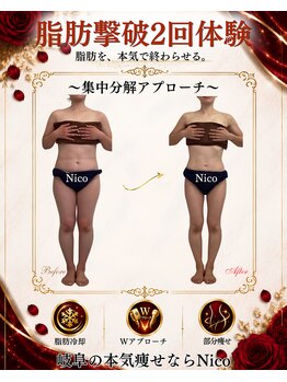 ニコ 岐南本店(Nico)の写真/結果最速!脂肪撃破2回体験|狙った脂肪を集中分解 19,800~