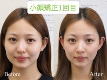 オズ六本木