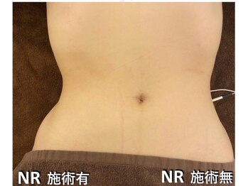 サロン リヒカ(Salon Rihica)/憧れのクビレも夢じゃない!