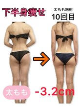 アフリオーラ はなみずき店(affriolant)/ビフォーアフター