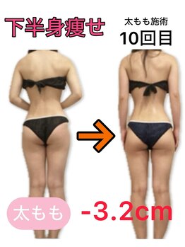 アフリオーラ はなみずき店(affriolant)/ビフォーアフター
