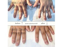 ネイルサロン ラグゼ(Nail salon Luxe)の雰囲気（初回★自爪育成深爪改善クリア施術・保湿パック付　7000円　）
