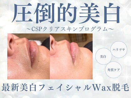 シロ(siro)の写真