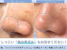 Cスキンケアクリニック 麻布店