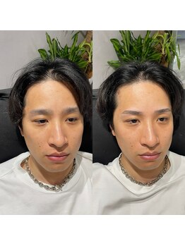 長崎 浜町店/before→after