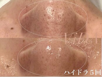 ヴィーダ 渋谷松濤(ViDA)/ハイドラ