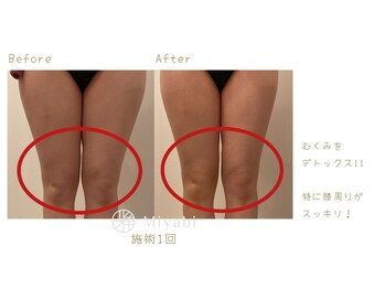 エナジーメソッド雅(miyabi)/むくみや老廃物へアプローチ