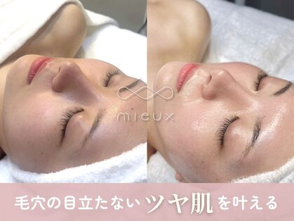 ミュー 本町店(mieux)の写真