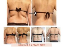 ピースツリー(PEACE TREE)/