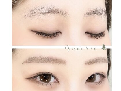 フレックル(freckle)の写真