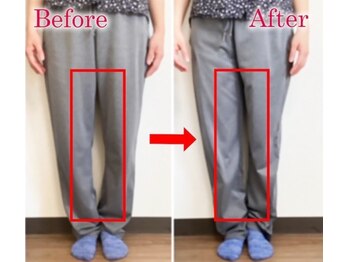 ライトワーク 西新宿店/O脚矯正