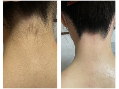 ルピナス(salon de Lupinus)の写真